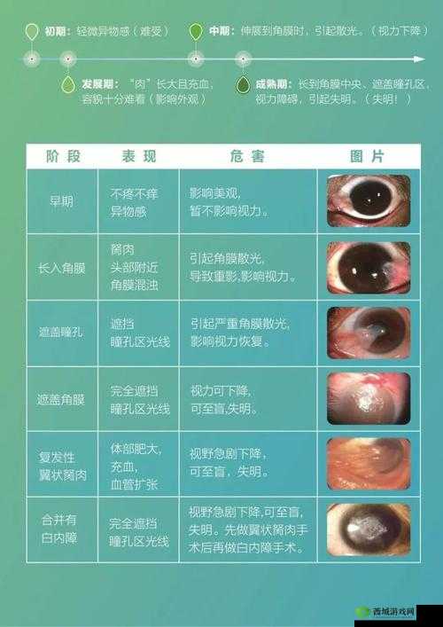 超级胬肉系统:功能强大的创新体系