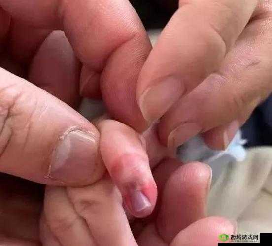 宝宝才三根手指就这么疼:手指插入的疼痛体验