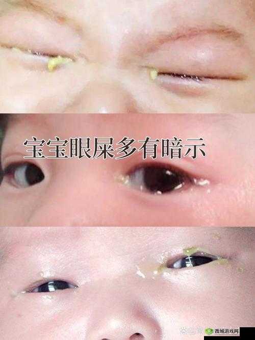 宝宝下面湿透了还嘴硬怎么回事儿:原因大揭秘