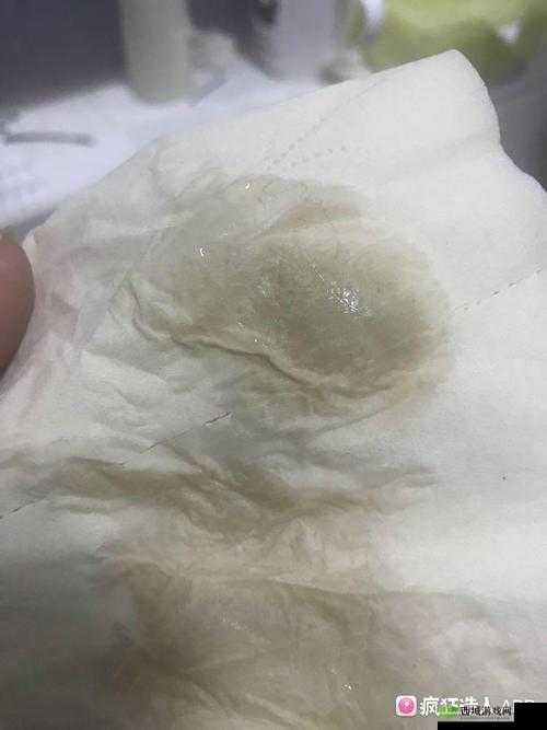 水拉丝了小东西怎么办:快来看看解决办法