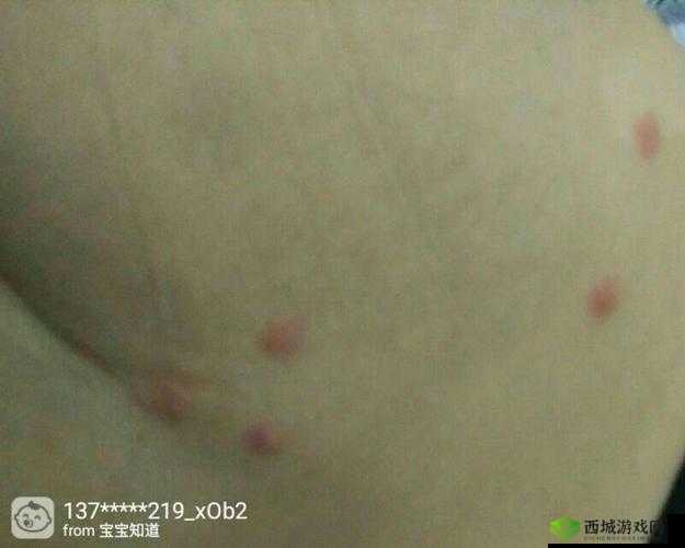 两个蛋蛋摸起来里面有疙瘩,需进一步检查