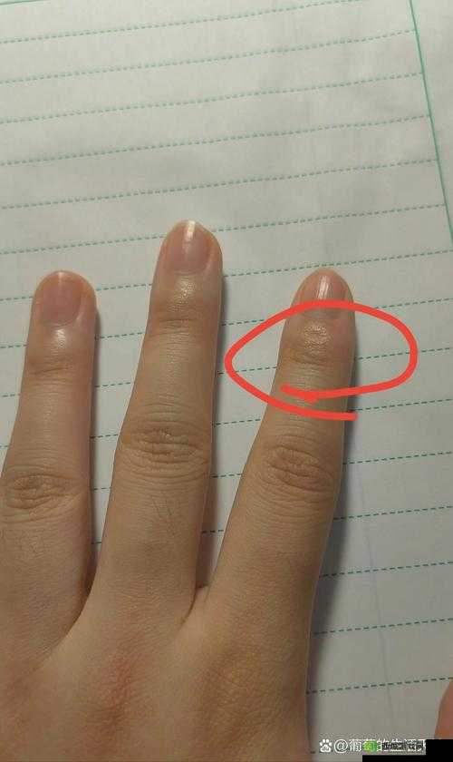 一根手指就疼了:到底怎么回事