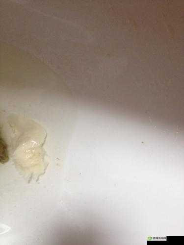 女生流出白白的东西怎么回事:原因分析