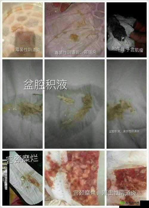 排阴毒奇人:老中医用嘴吸出女性下体毒素