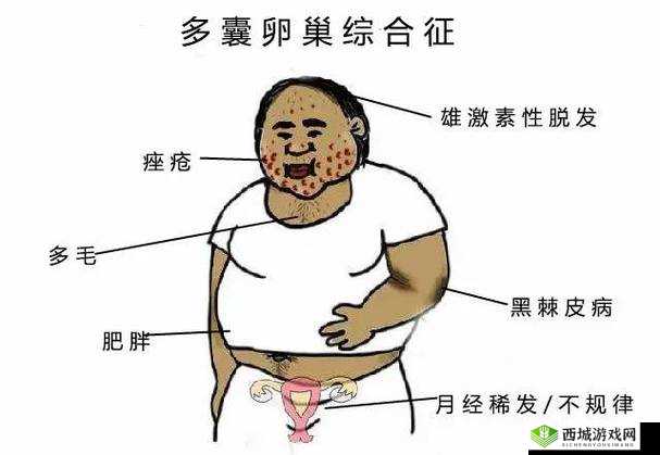 肥胖多毛老妇为何会出现这种现象?探秘肥胖多毛老妇背后的原因