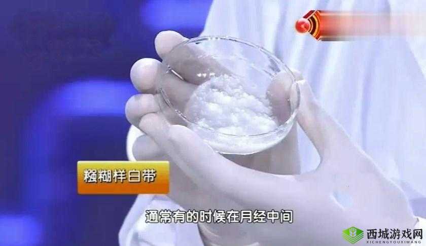 下面有白色浆糊一样的分泌物是怎么回事?如何应对这种情况?下面出现白色浆糊一样的分泌物,原因何在?怎样解决这一问题?下面有白色浆糊一样的分泌物,是正常现象还是身体发出的警报?