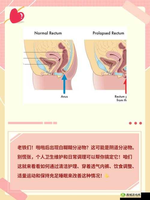 啪啪时流出白色液体是什么原因?专家解析健康隐患与应对方法